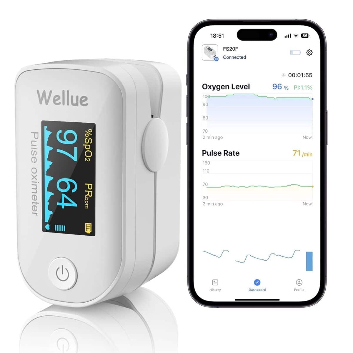 Oxymètre ViATOM Bluetooth : évaluez votre Saturation en Oxygène et Pouls