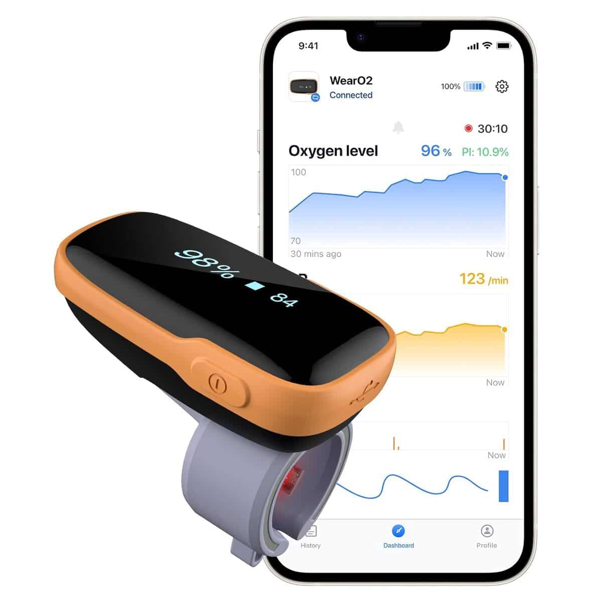 Test : oxymètre de doigt Wellue Bluetooth, performance et innovation
