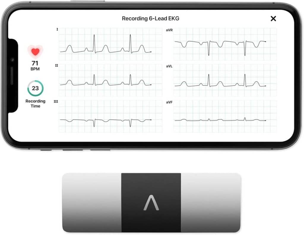 Test de l'AliveCor KardiaMobile 6L : l'ECG personnel connecté en 30 secondes