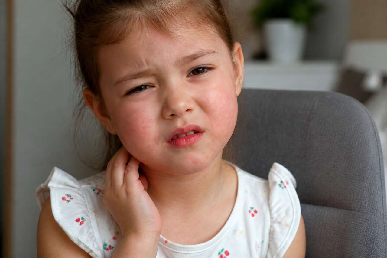 Symptômes des allergies alimentaires : comment les identifier